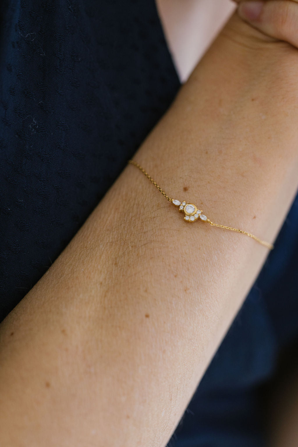 Radiant Bracelet
